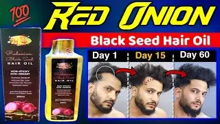 Red Onion Black Seed Hair Oil Review In Bangla | Best Onion Hair Oil