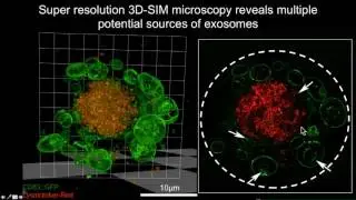 B Kroeger: New functions for ESCRTs & intraluminal vesicles