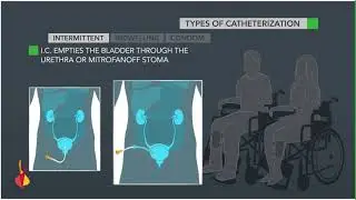 SCI & Bladder Management