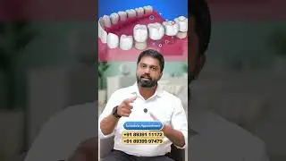 Dental Bridges vs Implants: When to Choose a Bridge for Tooth Replacement | Dr.Prem Alex Lawrence