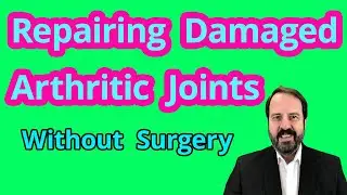 Arthritis, Degeneration, Bone on Bone: Can Your Joints Heal Again? - Michigan Integrative Health