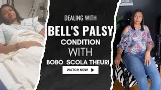 Bell's Palsy awareness with Scola Theuri