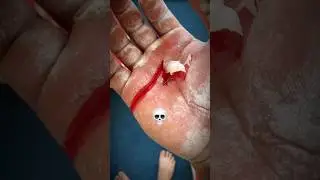 Мозоли это каждого боль спортсмена 💀😢 #sports #workout #trending