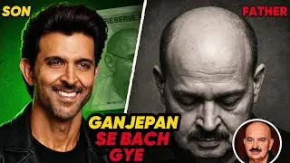 Hrithik Roshan Bald Mystery Solved! Why He’ll Never Go Ganj Like Rakesh Roshan | Hair Transplant