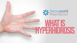What is Hyperhidrosis. #shots
