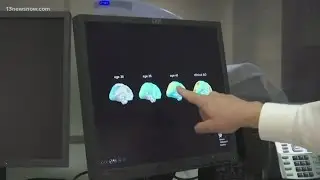 Support for patients with Alzheimer's disease