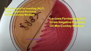 Lactose Fermenter and Non-lactose fermenter bacteria Demonstration