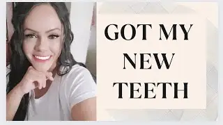 New Teeth Reveal: Before & After Transformation 🤩