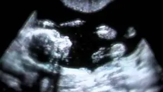 IntelliGender - Experience The Pregnancy Journey