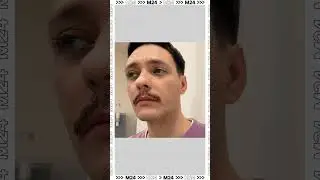Как щитовидная железа влияет на наш сон: гормоны и тревожные симптомы