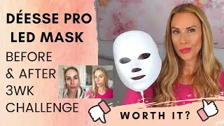 D&eacute;ese Pro LED Mask | 3wks Before & After | Honest Review