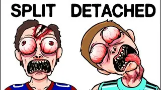 The Most Terrifying Sport Injuries Ever