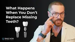 What Happens When You Don't Replace Missing Teeth?