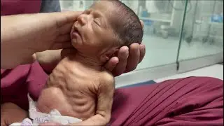 Day 2 Newborn Baby | Tiny Cute Hugs, Feeding & Sleeping Moments🤗🧑&zwj;🍼