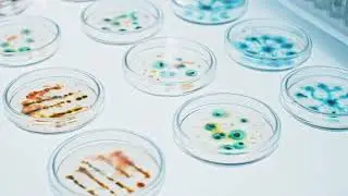 STEM Capstone Botulism Detection Device Project