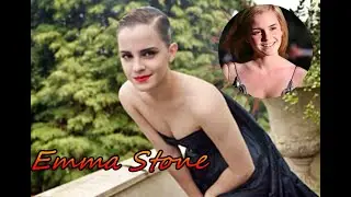 Emma Stone Shows Off More Than She Wanted To #Emma Stone #celebnews
