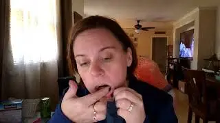 My Partial Denture Journey begins!
