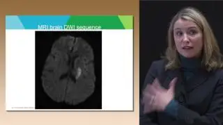 Acute Stroke Care
