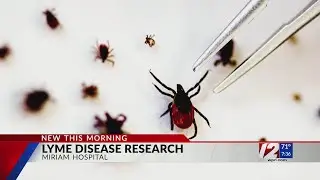 Lifespan Lyme Disease Center enrolling RI adults to learn more about ongoing symptoms