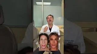 Are These Cosmetic Surgery Results REAL or FAKE?