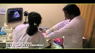Amniocentesis & Chorionic Villus Sampling (CVS)