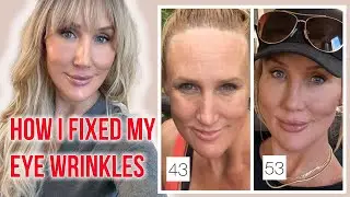 How I fixed My Eye Wrinkles - Methods that ACTUALLY work!