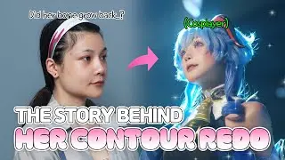From Cosplay to Real Life - Her Plastic Surgery Transformation🩷