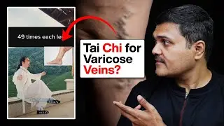Have YOU Tried TAI-CHI for Varicose Veins?