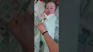 Infantile Spasms