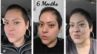 #cancer 6 Months after Chemo Hair Update
