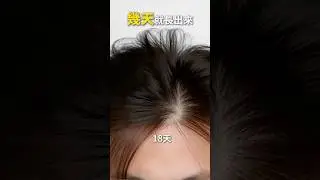 網路生髮廣告大揭密!!!?  【楊氏羅丹】