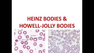 HEINZ BODIES and HOWELL-JOLLY BODIES