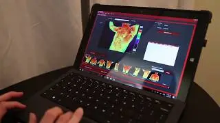 Breast Thermography &ndash; Well Life Family Medicine