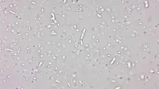 Microbial Activity in Compost Tea - 24 Hour