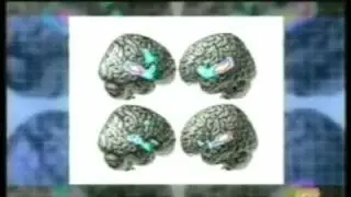 M&uacute;sica y plasticidad neuronal
