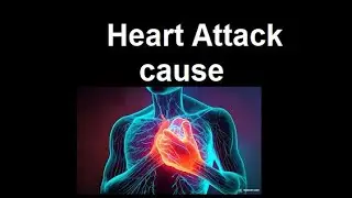 Heart Attacks  Symptoms | 2024