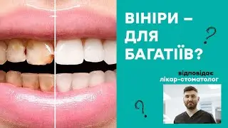 Виниры, импланты и отбеливание: Вся правда о зубах от стоматолога | Є здорове питанння