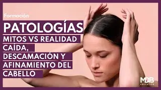 Aprende  sobre Caída, Descamación y Afinamiento de Cabello Mitos vs realidad. Soluciones y Servicios