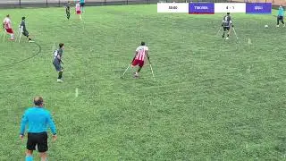 AMPUTE FUTBOL S&Uuml;PER LİG TSK REH. VS ŞİŞLİ