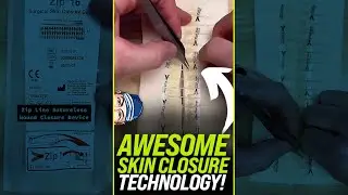 Awesome Surgical Skin Closure Technology 😍 #shorts