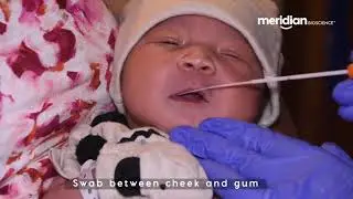Newborn Saliva Sample Collection for CMV Testing.mp4