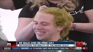 Be Bald and Be Free Day