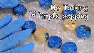 ASMR 👩🏻&zwj;⚕️ | No talking | Pimple popping | Jumbo big Bubble wrap.👉🏼🔵👈🏼