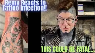 Remy Reacts to Tattoo Infection Nightmare