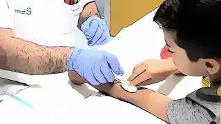 Autotratamiento en pacientes con Hemofilia II (avanzado)