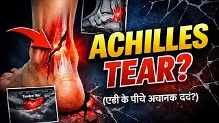 Sudden Heel Pain? Achilles Tear Ho Sakta Hai! Dr Chandan Narang / Foot And Ankle Surgeon |Fortis