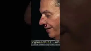 😱&iexcl;#OctavioElizondo sufri&oacute; graves consecuencias al realizar un ritual!😳🩸 #Extranormal