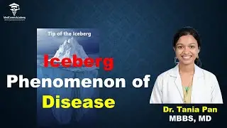 Феномен айсберга в изучении болезней: объяснение. Доктор Таня Пан (MBBS, MD)