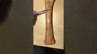 Equine Radius and Ulna - Veterinary Anatomy