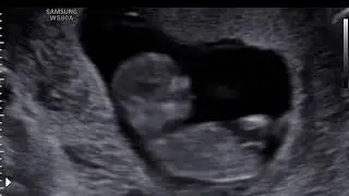 Baby 11 weken